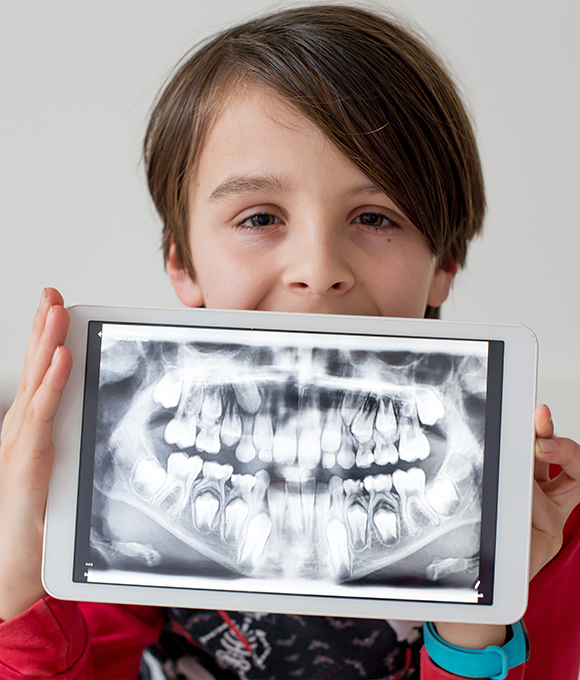 Child holding a tablet with dental x ray in front of their mouth