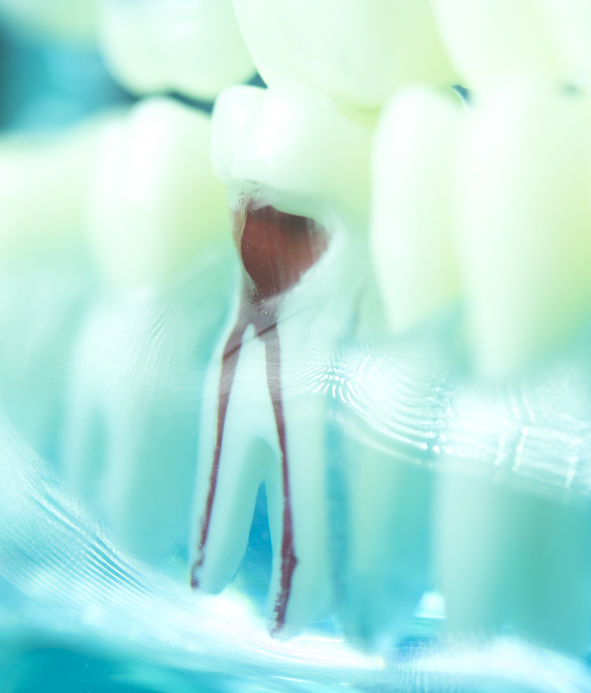 Model of tooth showing root canals inside of it