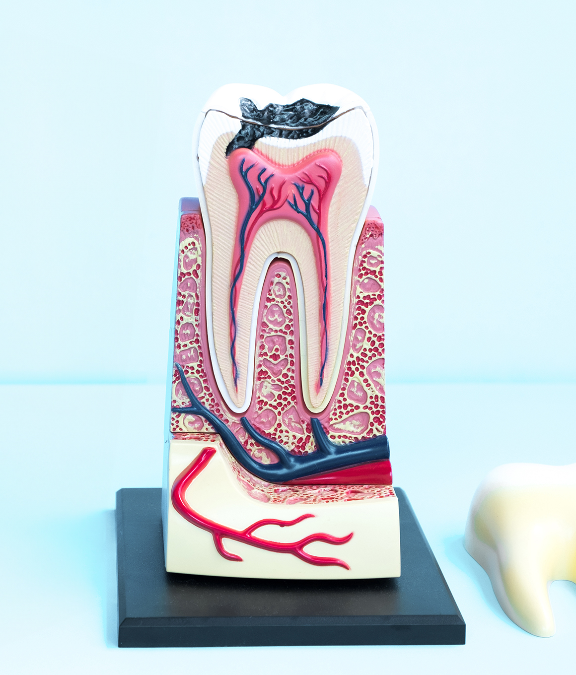 Model showing inner layers of tooth